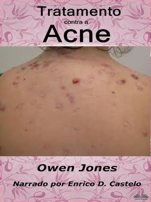 cover image of Tratamento contra a acne
